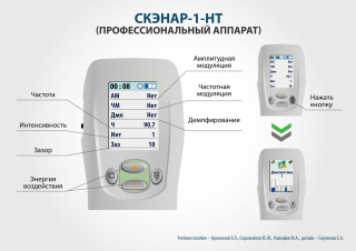 СКЭНАР-1-НТ (исполнение 01)  в Обнинске купить Скэнар официальный сайт - denasvertebra.ru 